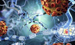 فواید قارچ گانودرما برای درمان بیماری ام اس فواید قارچ گانودرما برای درمان بیماری ام اس