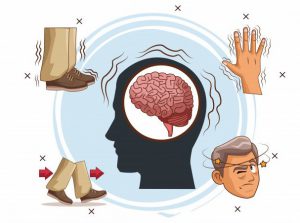 فواید قارچ گانودرما برای درمان پارکینسون فواید قارچ گانودرما برای درمان پارکینسون