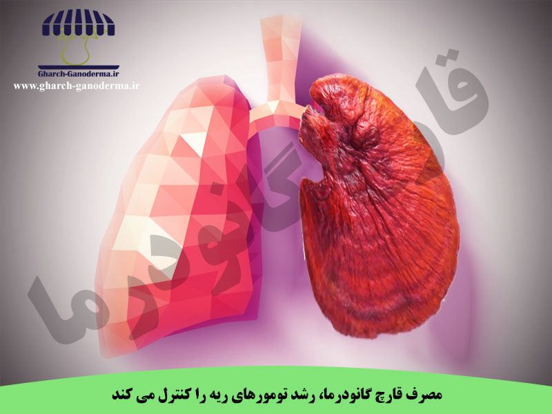 درمان تومورهای ریه با قارچ گانودرما